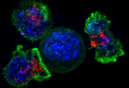 MD安德森癌症中心的研究人员发现蛋白质可促进癌症并且抑制免疫系统