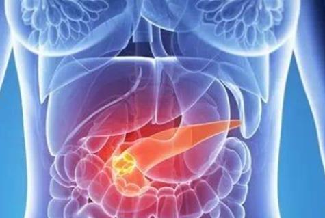 胰腺癌什么情况下可以进行手术