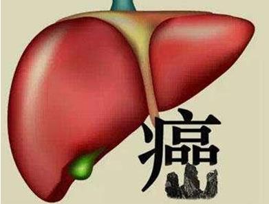 肝癌形成的原因是什么