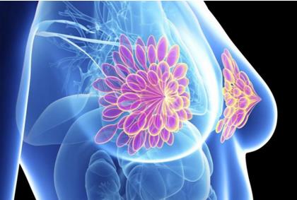 早期乳腺癌的新疗法