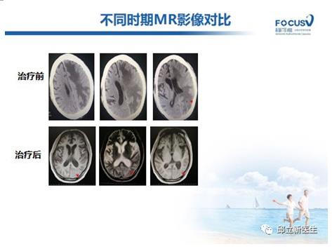 基因检测没有突变，可以用靶向药吗？