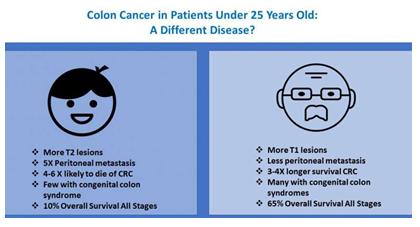 儿童结直肠癌是另一种疾病