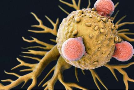 新发现的免疫细胞可能是改善胰腺癌免疫疗法的关键