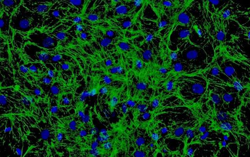 靶向基质细胞可能有助于克服脑瘤的治疗耐药性