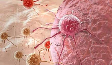 昆士兰大学新研究表明：PCZ有助于提升肿瘤细胞内的药物靶标表达