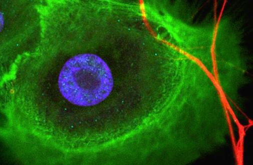 研究人员发现干细胞和神经细胞在组织再生和癌症进展中的相互作用