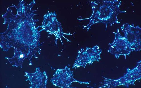 癌细胞与成纤维细胞的相互作用会促进癌症转移