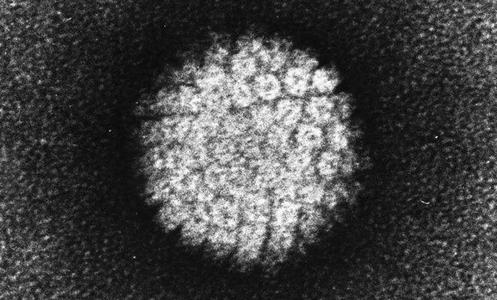 科学家已找到阻止致癌HPV病毒的新方法