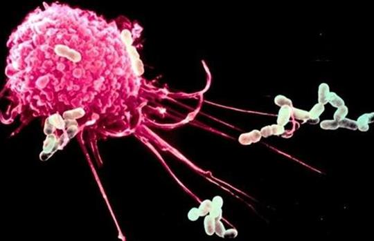 新免疫疗法将有望阻碍卵巢癌的扩散