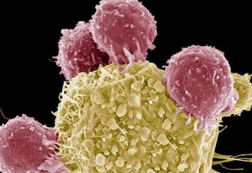 虚拟细胞可预测肿瘤环境如何影响癌症转移