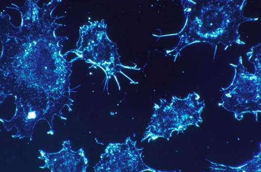 研究人员提醒： 新冠疫情期间不要忽视癌症的疑似症状