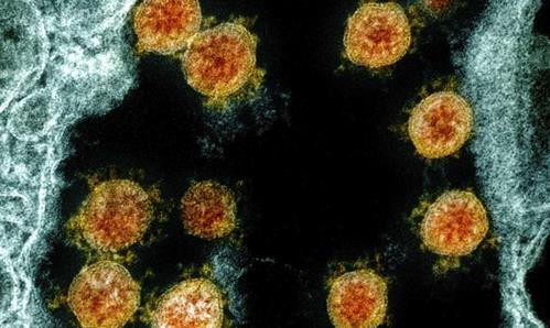 新研究发现，癌症和冠状病毒是危险的组合