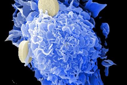前所未有的细胞状态可能解释了癌症抵抗药物的能力