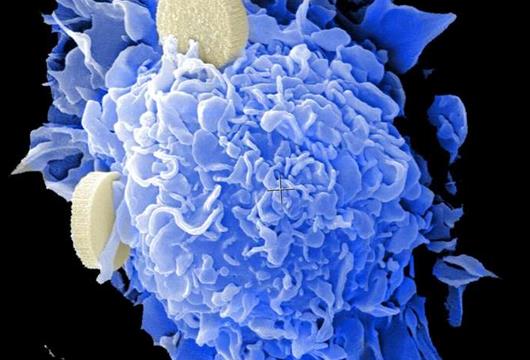 小分子治疗可减少结肠癌转移