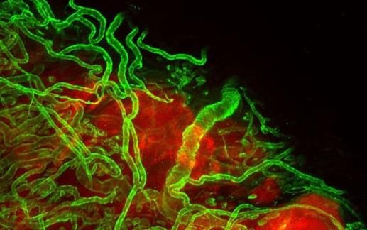 研究人员发现癌细胞如何远处转移且控制血管的过程