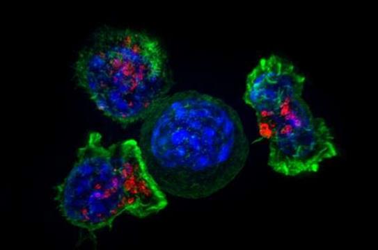 科学家们鉴定出数十种帮助癌细胞逃避免疫系统的基因