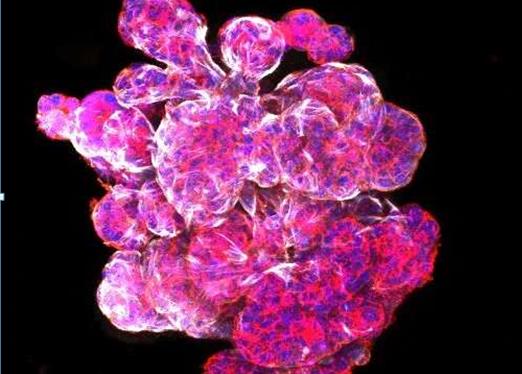 研究人员发现治疗乳腺癌的新联合用药
