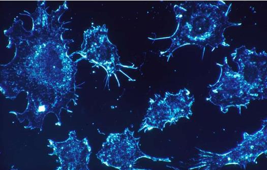 巨噬细胞在癌症扩散中的作用