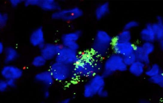 研究人员发现新的增强免疫系统抵抗癌症方法