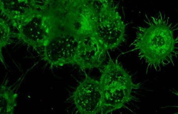 科学家们为NK细胞增加靶向能力，从而治疗淋巴瘤